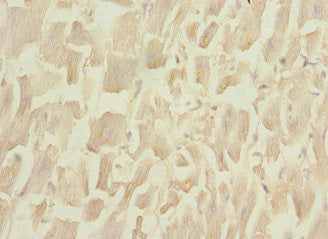 Immunohistochemistry of paraffin-embedded human heart tissue using PLA2G4C Antibody at dilution of 1:100