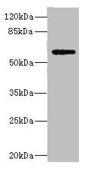 Western blot | All lanes: COX10 antibody at 5.84μg/ml + Mouse heart tissue | Secondary | Goat polyclonal to rabbit IgG at 1/10000 dilution | Predicted band size: 61, 60, 63 kDa | Observed band size: 61 kDa