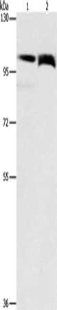 Gel: 6%SDS-PAGE, Lysate: 40 μg, Lane 1-2: Lovo cells, 231 cells, Primary antibody: FLT3 Antibody(FLT3 Antibody) at dilution 1/240, Secondary antibody: Goat anti rabbit IgG at 1/8000 dilution, Exposure time: 15 seconds