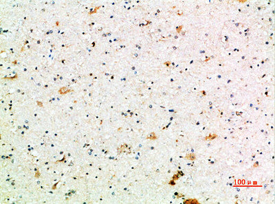 Immunohistochemical analysis of paraffin-embedded human-brain, antibody was diluted at 1:200