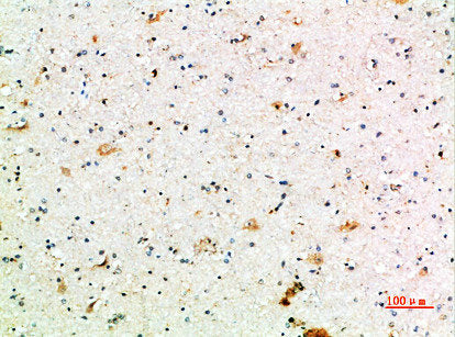 Immunohistochemical analysis of paraffin-embedded human-brain, antibody was diluted at 1:200