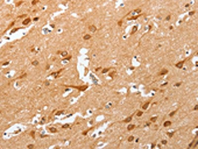 The image on the left is immunohistochemistry of paraffin-embedded Human brain  tissue using PLA2G4A Antibody(PLA2G4A Antibody) at dilution 1/50, on the right is treated with fusion protein. (Original magnification: ×200)