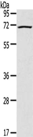 Gel: 8%SDS-PAGE,Lysate: 40 μg,,Primary antibody: LILRB2 Antibody(LILRB2 Antibody) at dilution 1/200 dilution,Secondary antibody: Goat anti rabbit IgG at 1/8000 dilution,Exposure time: 2 minutes