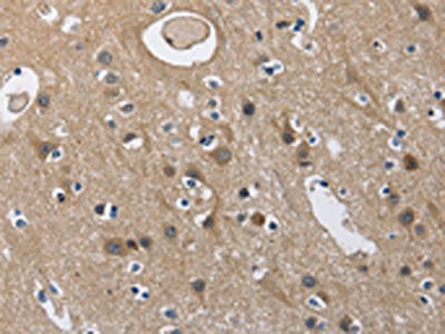 The image on the left is immunohistochemistry of paraffin-embedded Human brain  tissue using CD160 Antibody(CD160 Antibody) at dilution 1/60, on the right is treated with fusion protein. (Original magnification: ×200)