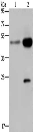 Gel: 10%SDS-PAGE, Lysate: 40 μg, Lane 1-2: 231 cells, Hela cells, Primary antibody: CD160 Antibody(CD160 Antibody) at dilution 1/300, Secondary antibody: Goat anti rabbit IgG at 1/8000 dilution, Exposure time: 40 seconds