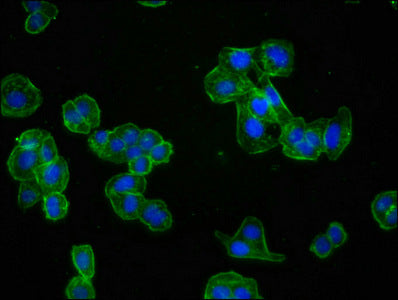 Immunofluorescence staining of HepG2 cells with ACTA1 Recombinant Monoclonal Antibody at 1:60,counter-stained with DAPI. The cells were fixed in 4% formaldehyde, permeabilized using 0.2% Triton X-100 and blocked in 10% normal Goat Serum. The cells were then incubated with the antibody overnight at 4℃.The secondary antibody was Alexa Fluor 488-congugated AffiniPure Goat Anti-Rabbit IgG (H+L).