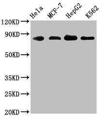 Western Blot | Positive WB detected in: Hela whole cell lysate, MCF-7 whole cell lysate, HepG2 whole cell lysate, K562 whole cell lysate | All lanes: ARNT antibody at 1.83μg/ml | Secondary | Goat polyclonal to rabbit IgG at 1/50000 dilution | Predicted band size: 87, 85, 86 KDa | Observed band size: 87 KDa