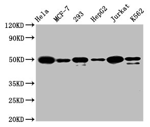 Western Blot | Positive WB detected in: Hela whole cell lysate, MCF-7 whole cell lysate, 293 whole cell lysate, HepG2 whole cell lysate, Jurkat whole cell lysate, K562 whole cell lysate | All lanes: ATF4 antibody at 1.6μg/ml | Secondary | Goat polyclonal to rabbit IgG at 1/50000 dilution | Predicted band size: 39 KDa | Observed band size: 50 KDa