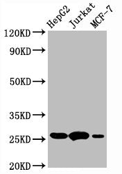 Western Blot | Positive WB detected in:HepG2 whole cell lysate,Jurkat whole cell lysate,MCF-7 whole cell lysate | All lanes:BCL2 antibody at 1μg/ml | Secondary | Goat polyclonal to rabbit IgG at 1/50000 dilution | Predicted band size: 26 KDa | Observed band size: 26 KDa