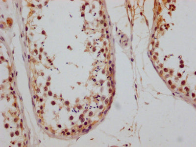 IHC image of CD147 Recombinant Monoclonal Antibody diluted at 1:200 and staining in paraffin-embedded human testis tissue performed on a Leica BondTM system. After dewaxing and hydration, antigen retrieval was mediated by high pressure in a citrate buffer (pH 6.0). Section was blocked with 10% normal goat serum 30min at RT. Then primary antibody (1% BSA) was incubated at 4°C overnight. The primary is detected by a Goat anti-mouse polymer IgG labeled by HRP and visualized using 0.05% DAB.