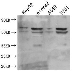 Western Blot | Positive WB detected in: HepG2 whole cell lysate, ntera2 whole cell lysate, A549 whole cell lysate, U251 whole cell lysate  | All lanes: CD147 antibody at 1:1000 | Secondary | Goat polyclonal to mouse IgG at 1/50000 dilution | Predicted band size: 42, 29, 23, 19 KDa | Observed band size: 35, 50-60 KDa