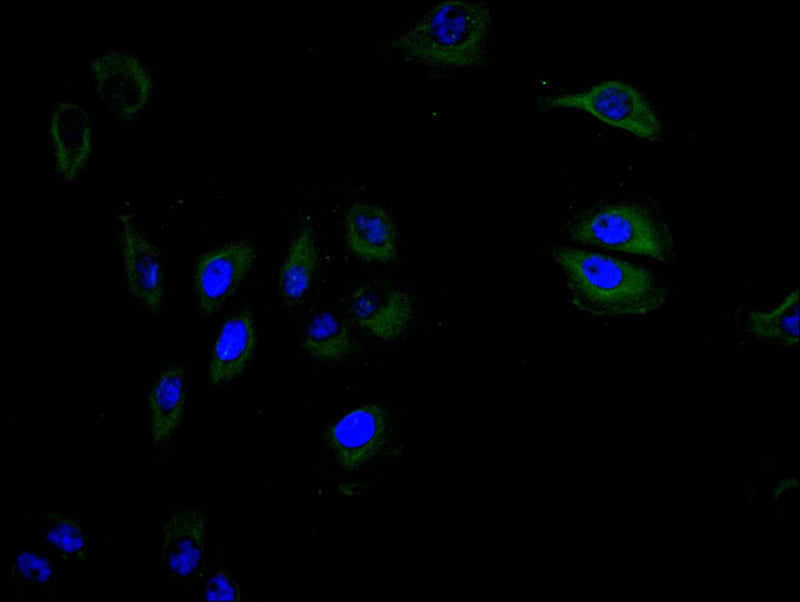 Immunofluorescence staining of A549 cell with the antibody at 1:30, counter-stained with DAPI. The cells were fixed in 4% formaldehyde and blocked in 10% normal Goat Serum. The cells were then incubated with the antibody overnight at 4C. The secondary antibody was FITC-conjugated AffiniPure Goat Anti-mouse IgG(H+L).