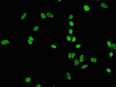 Immunofluorescence staining of Hela cells(treated by 15mM sodium butyrate for 30min) with Acetyl-Histone H4 (K5) Recombinant Monoclonal Antibody at 1:65,counter-stained with DAPI. The cells were fixed in 4% formaldehyde, permeabilized using 0.2% Triton X-100 and blocked in 10% normal Goat Serum. The cells were then incubated with the antibody overnight at 4℃.The secondary antibody was Alexa Fluor 488-congugated AffiniPure Goat Anti-Rabbit IgG (H+L).