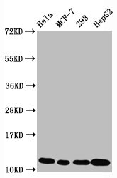 Western Blot | Positive WB detected in Hela whole cell lysate, MCF-7 whole cell lysate, 293 whole cell lysate, HepG2 whole cell lysate | All lanes Acetyl-Histone H4 (K5) antibody at 1.05μg/ml | Secondary | Goat polyclonal to rabbit IgG at 1/50000 dilution | Predicted band size: 11 KDa | Observed band size: 11 KDa