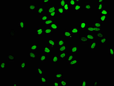 Immunofluorescence staining of Hela cells(treated by 15mM sodium butyrate for 30min) with Acetyl-Histone H4 (K16) Recombinant Monoclonal Antibody at 1:403,counter-stained with DAPI. The cells were fixed in 4% formaldehyde, permeabilized using 0.2% Triton X-100 and blocked in 10% normal Goat Serum. The cells were then incubated with the antibody overnight at 4℃.The secondary antibody was Alexa Fluor 488-congugated AffiniPure Goat Anti-Rabbit IgG (H+L).