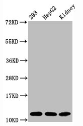 Western BlotPositive WB detected in:293 whole cell lysate, HepG2 whole cell lysate, Mouse kidney tissueAll lanes:Acetyl-Histone H4 (K16) antibody at 1.65μg/mlSecondaryGoat polyclonal to rabbit IgG at 1/50000 dilutionPredicted band size: 11 KDaObserved band size: 11 KDa