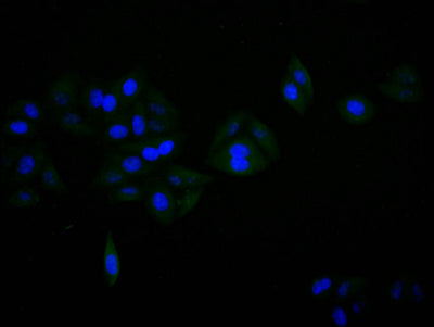 Immunofluorescence staining of SH-SY5Y cell with SNCA Recombinant Monoclonal Antibody at 1:30, counter-stained with DAPI. The cells were fixed in 4% formaldehyde and blocked in 10% normal Goat Serum. The cells were then incubated with the antibody overnight at 4C. The secondary antibody was FITC-conjugated AffiniPure Goat Anti-Mouse IgG(H+L).