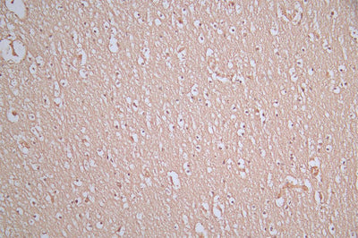 IHC image of the antibody diluted at 1:100 and staining in paraffin-embedded human brain tissue performed on a Leica BondTM system. After dewaxing and hydration, antigen retrieval was mediated by high pressure in a citrate buffer (pH 6.0). Section was blocked with 10% normal goat serum 30min at RT. Then primary antibody (1% BSA) was incubated at 4°C overnight. The primary is detected by a Goat anti-Mouse IgG labeled by HRP and visualized using 0.05% DAB.