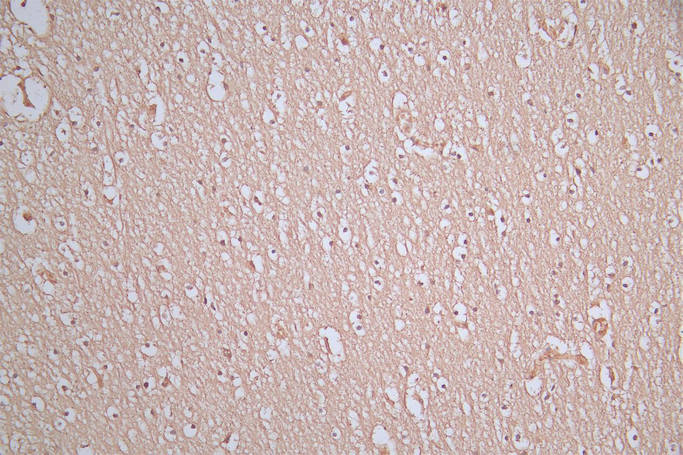 IHC image of the antibody diluted at 1:100 and staining in paraffin-embedded human brain tissue performed on a Leica BondTM system. After dewaxing and hydration, antigen retrieval was mediated by high pressure in a citrate buffer (pH 6.0). Section was blocked with 10% normal goat serum 30min at RT. Then primary antibody (1% BSA) was incubated at 4°C overnight. The primary is detected by a Goat anti-Mouse IgG labeled by HRP and visualized using 0.05% DAB.