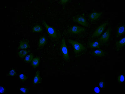 Immunofluorescence staining of A549 cell with SNRPD1 Recombinant Monoclonal Antibody at 1:20, counter-stained with DAPI. The cells were fixed in 4% formaldehyde and blocked in 10% normal Goat Serum. The cells were then incubated with the antibody overnight at 4C. The secondary antibody was Alexa Fluor 488-congugated AffiniPure Goat Anti-Mouse IgG(H+L).