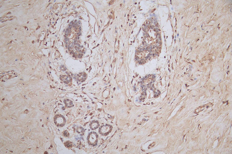 IHC image of the antibody diluted at 1:50 and staining in paraffin-embedded human breast tissue performed on a Leica BondTM system. After dewaxing and hydration, antigen retrieval was mediated by high pressure in a citrate buffer (pH 6.0). Section was blocked with 10% normal goat serum 30min at RT. Then primary antibody (1% BSA) was incubated at 4°C overnight. The primary is detected by a Goat anti-mouse polymer IgG labeled by HRP and visualized using 0.05% DAB.