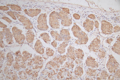 IHC image of SNRPD1 Recombinant Monoclonal Antibody diluted at 1:50 and staining in paraffin-embedded human stomach tissue performed on a Leica BondTM system. After dewaxing and hydration, antigen retrieval was mediated by high pressure in a citrate buffer (pH 6.0). Section was blocked with 10% normal goat serum 30min at RT. Then primary antibody (1% BSA) was incubated at 4°C overnight. The primary is detected by a Goat anti-mouse polymer IgG labeled by HRP and visualized using 0.05% DAB.