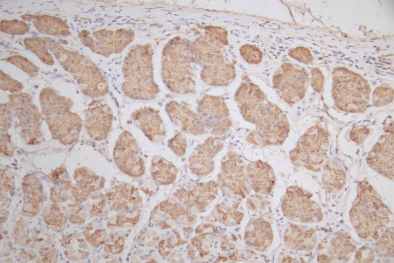 IHC image of SNRPD1 Recombinant Monoclonal Antibody diluted at 1:50 and staining in paraffin-embedded human stomach tissue performed on a Leica BondTM system. After dewaxing and hydration, antigen retrieval was mediated by high pressure in a citrate buffer (pH 6.0). Section was blocked with 10% normal goat serum 30min at RT. Then primary antibody (1% BSA) was incubated at 4°C overnight. The primary is detected by a Goat anti-mouse polymer IgG labeled by HRP and visualized using 0.05% DAB.