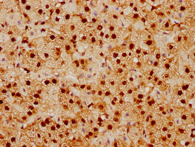 IHC image of the antibody diluted at 1:92.5 and staining in paraffin-embedded human adrenal gland tissue performed on a Leica BondTM system. After dewaxing and hydration, antigen retrieval was mediated by high pressure in a citrate buffer (pH 6.0). Section was blocked with 10% normal goat serum 30min at RT. Then primary antibody (1% BSA) was incubated at 4℃ overnight. The primary is detected by a biotinylated secondary antibody and visualized using an HRP conjugated SP system.