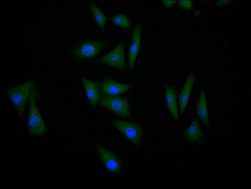 Immunofluorescence staining of MCF-7 cell with TP53 Recombinant Monoclonal Antibody at 1:60, counter-stained with DAPI. The cells were fixed in 4% formaldehyde and blocked in 10% normal Goat Serum. The cells were then incubated with the antibody overnight at 4C. The secondary antibody was Alexa Fluor 488-congugated AffiniPure Goat Anti-Rabbit IgG(H+L).