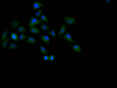 Immunofluorescence staining of Hela cell with TP53 Recombinant Monoclonal Antibody at 1:60, counter-stained with DAPI. The cells were fixed in 4% formaldehyde and blocked in 10% normal Goat Serum. The cells were then incubated with the antibody overnight at 4C. The secondary antibody was Alexa Fluor 488-congugated AffiniPure Goat Anti-Rabbit IgG(H+L).