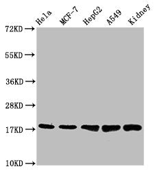 Western Blot | Positive WB detected in: Hela whole cell lysate, MCF-7 whole cell lysate, HepG2 whole cell lysate, A549 whole cell lysate, Mouse kidney tissue | All lanes: PBR antibody at 1.2μg/ml | Secondary | Goat polyclonal to rabbit IgG at 1/50000 dilution | Predicted band size: 19, 11 KDa | Observed band size: 19 KDa