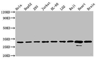 Western Blot | Positive WB detected in: Hela whole cell lysate, HepG2 whole cell lysate, 293 whole cell lysate, Jurkat whole cell lysate, HL-60 whole cell lysate, LO2 whole cell lysate, Raji whole cell lysate, Rat heart tissue, Mouse brain tissue | All lanes: VDAC1 antibody at 0.7μg/ml | Secondary | Goat polyclonal to rabbit IgG at 1/50000 dilution | Predicted band size: 31 KDa | Observed band size: 31 KDa