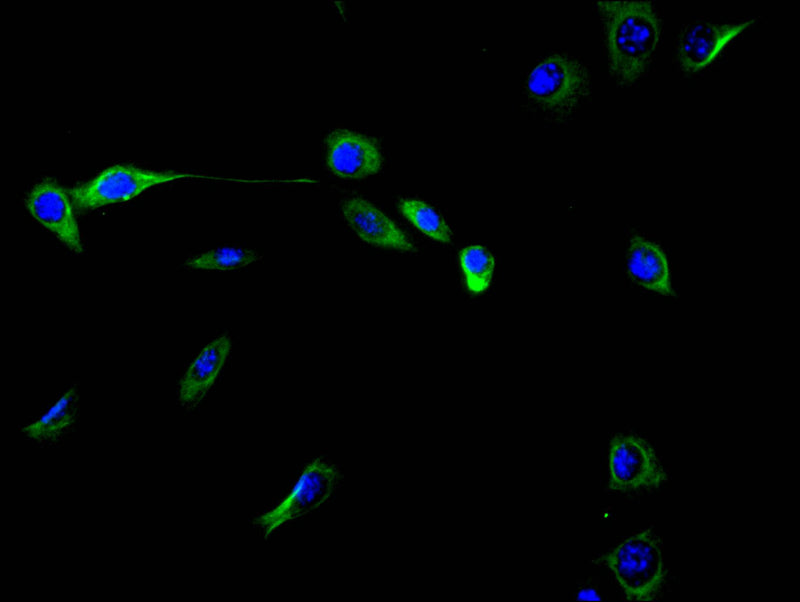 Immunofluorescence staining of NIH/3T3 cell with VIM Recombinant Monoclonal Antibody at 1:40, counter-stained with DAPI. The cells were fixed in 4% formaldehyde and blocked in 10% normal Goat Serum. The cells were then incubated with the antibody overnight at 4C. The secondary antibody was FITC-conjugated AffiniPure Goat Anti-Rabbit IgG(H+L).