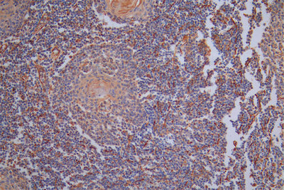 IHC image of the antibody diluted at 1:40 and staining in paraffin-embedded human tonsil tissue performed on a Leica BondTM system. After dewaxing and hydration, antigen retrieval was mediated by high pressure in a citrate buffer (pH 6.0). Section was blocked with 10% normal goat serum 30min at RT. Then primary antibody (1% BSA) was incubated at 4°C overnight. The primary is detected by a Goat anti-Rabbit IgG labeled by HRP and visualized using 0.05% DAB.