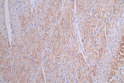 IHC image of the antibody diluted at 1:50 and staining in paraffin-embedded human heart tissue performed on a Leica BondTM system. After dewaxing and hydration, antigen retrieval was mediated by high pressure in a citrate buffer (pH 6.0). Section was blocked with 10% normal goat serum 30min at RT. Then primary antibody (1% BSA) was incubated at 4°C overnight. The primary is detected by a Goat anti-rabbit polymer IgG labeled by HRP and visualized using 0.16% DAB.