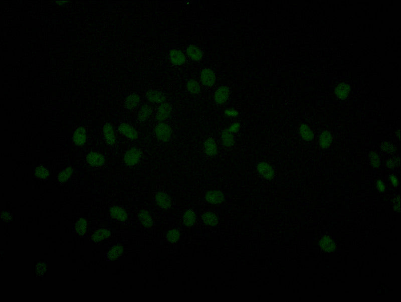 Immunofluorescence staining of Hela with SMARCA4 Recombinant Monoclonal Antibody at 1:20, counter-stained with DAPI. The cells were fixed in 4% formaldehyde and blocked in 10% normal Goat Serum. The cells were then incubated with the antibody overnight at 4°C. The secondary antibody was Alexa Fluor 511-congugated AffiniPure Goat Anti-Rabbit IgG(H+L).