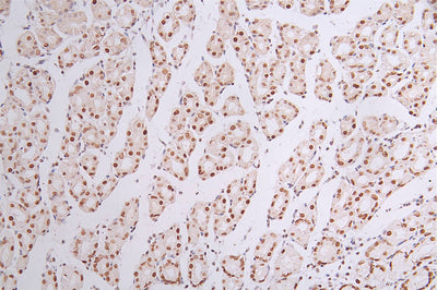 IHC image of the antibody diluted at 1:50 and staining in paraffin-embedded human stomach tissue performed on a Leica BondTM system. After dewaxing and hydration, antigen retrieval was mediated by high pressure in a citrate buffer (pH 6.0). Section was blocked with 10% normal goat serum 30min at RT. Then primary antibody (1% BSA) was incubated at 4°C overnight. The primary is detected by a Goat anti-rabbit polymer IgG labeled by HRP and visualized using 0.44% DAB.