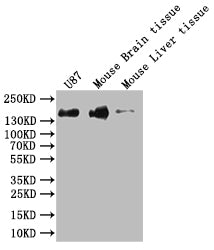 Western Blot | Positive WB detected in: Hela whole cell lysate, K562 whole cell lysate, U-87 whole cell lysate, Mouse Brain whole cell lysate | All lanes: SF3B1 antibody at 1:1000 | Secondary | Goat polyclonal to rabbit IgG at 1/50000 dilution | Predicted band size: 146, 17 kDa | Observed band size: 130 kDa