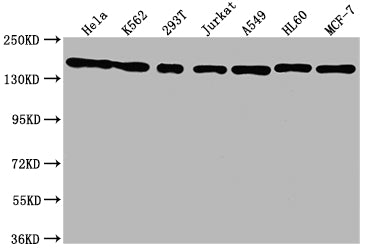 Western Blot | Positive WB detected in: Hela whole cell lysate, K562 whole cell lysate, 293T whole cell lysate, Jurkat whole cell lysate, A549 whole cell lysate, HL60 whole cell lysate, MCF-7 whole cell lysate | All lanes: SMC1A antibody at 1:1500 | Secondary | Goat polyclonal to rabbit IgG at 1/50000 dilution | Predicted band size: 144 kDa | Observed band size: 144 kDa