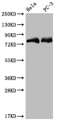 Western Blot | Positive WB detected in: Hela whole cell lysate, PC3 whole cell lysate | All lanes: SENP1 antibody at 1:2000 | Secondary | Goat polyclonal to rabbit IgG at 1/50000 dilution | Predicted band size: 74 kDa | Observed band size: 72-95 kDa