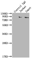 Immunoprecipitating SUZ12 in K562 whole cell lysate | Lane 1: Rabbit control IgG instead of SUZ12 Recombinant Monoclonal Antibody in K562 whole cell lysate. | For western blotting,a HRP-conjugated Protein G antibody was used as the secondary antibody (1/2000) | Lane 2: SUZ12 Recombinant Monoclonal Antibody(2µg)+ K562 whole cell lysate(500µg) | Lane 3: K562 whole cell lysate (10µg)