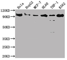 Western Blot | Positive WB detected in: Hela whole cell lysate, HepG2 whole cell lysate, MCF-7 whole cell lysate, HL60 whole cell lysate, THP-1 whole cell lysate, K562 whole cell lysate | All lanes: SUZ12 antibody at 1:2000 | Secondary | Goat polyclonal to rabbit IgG at 1/50000 dilution | Predicted band size: 84 kDa | Observed band size: 90 kDa