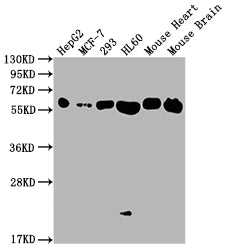 Western Blot | Positive WB detected in: HepG2 whole cell lysate, MCF-7 whole cell lysate, 293 whole cell lysate, HL60 whole cell lysate, Mouse Heart tissue, Mouse Brain tissue | All lanes: ATP5F1A antibody at 1:2000 | Secondary | Goat polyclonal to rabbit IgG at 1/50000 dilution | Predicted band size: 60, 55, 58 kDa | Observed band size: 60 kDa