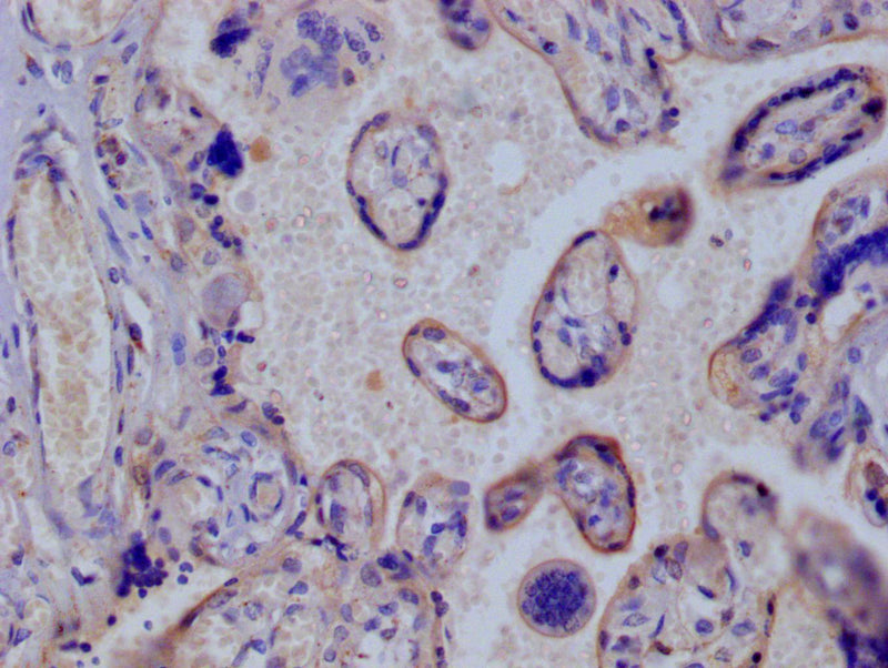 IHC image of SLC2A3 Recombinant Monoclonal Antibody diluted at 1:100 and staining in paraffin-embedded human placenta tissue performed on a Leica BondTM system. After dewaxing and hydration, antigen retrieval was mediated by high pressure in a citrate buffer (pH 6.0). Section was blocked with 10% normal goat serum 30min at RT. Then primary antibody (1% BSA) was incubated at 4°C overnight. The primary is detected by a Goat anti-rabbit polymer IgG labeled by HRP and visualized using 0.05% DAB.