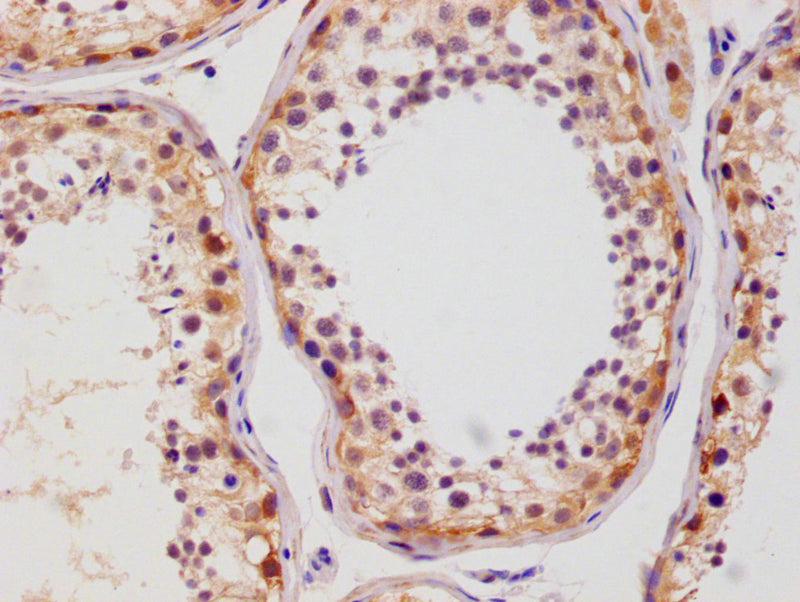 IHC image of SLC2A3 Recombinant Monoclonal Antibody diluted at 1:100 and staining in paraffin-embedded human testis tissue performed on a Leica BondTM system. After dewaxing and hydration, antigen retrieval was mediated by high pressure in a citrate buffer (pH 6.0). Section was blocked with 10% normal goat serum 30min at RT. Then primary antibody (1% BSA) was incubated at 4°C overnight. The primary is detected by a Goat anti-rabbit polymer IgG labeled by HRP and visualized using 0.05% DAB.