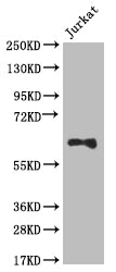 Western Blot | Positive WB detected in: Jurkat whole cell lysate | All lanes: SLC2A3 antibody at 1:1000 | Secondary | Goat polyclonal to rabbit IgG at 1/50000 dilution | Predicted band size: 54 kDa | Observed band size: 55-70 kDa