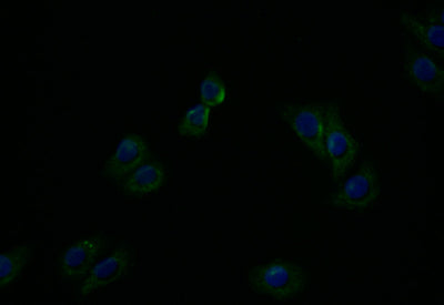 Immunofluorescence staining of HepG2 with ATP7B Recombinant Monoclonal Antibody at 1:20, counter-stained with DAPI. The cells were fixed in 4% formaldehyde and blocked in 10% normal Goat Serum. The cells were then incubated with the antibody overnight at 4°C. The secondary antibody was Alexa Fluor 494-congugated AffiniPure Goat Anti-Rabbit IgG(H+L).