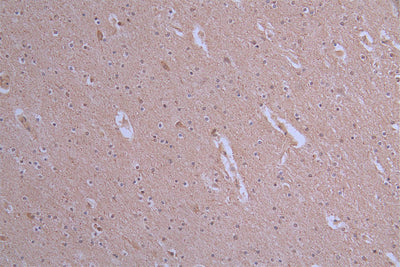 IHC image of the antibody diluted at 1:50 and staining in paraffin-embedded human brain tissue performed on a Leica BondTM system. After dewaxing and hydration, antigen retrieval was mediated by high pressure in a citrate buffer (pH 6.0). Section was blocked with 10% normal goat serum 30min at RT. Then primary antibody (1% BSA) was incubated at 4°C overnight. The primary is detected by a Goat anti-rabbit polymer IgG labeled by HRP and visualized using 0.19% DAB.