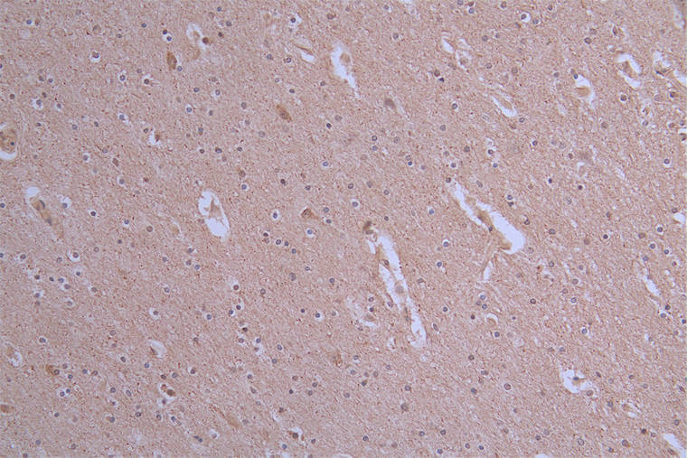 IHC image of the antibody diluted at 1:50 and staining in paraffin-embedded human brain tissue performed on a Leica BondTM system. After dewaxing and hydration, antigen retrieval was mediated by high pressure in a citrate buffer (pH 6.0). Section was blocked with 10% normal goat serum 30min at RT. Then primary antibody (1% BSA) was incubated at 4°C overnight. The primary is detected by a Goat anti-rabbit polymer IgG labeled by HRP and visualized using 0.19% DAB.