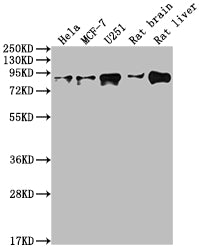 Western Blot | Positive WB detected in: Hela whole cell lysate, MCF-7 whole cell lysate, U251 whole cell lysate, Rat brain tissue, Rat liver tissue | All lanes: VCP antibody at 1:2000 | Secondary | Goat polyclonal to rabbit IgG at 1/50000 dilution | Predicted band size: 90 kDa | Observed band size: 90 kDa